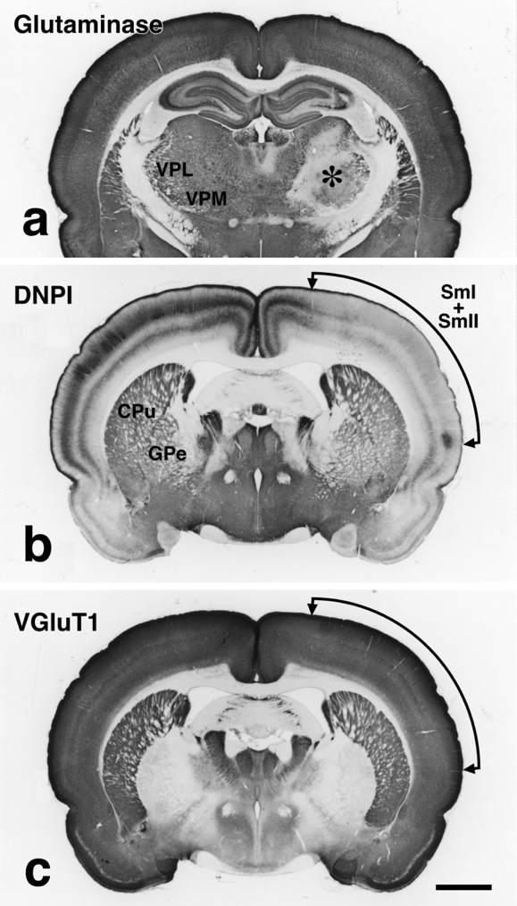視床の破壊実験の結果、VGluT (現在のVGluT1) とDNPI (現在のVGluT2) が、各々大脳皮質と視床から出力する軸索終末において、小胞性グルタミン酸トランスポーターとして使い分けられていることを初めて報告した